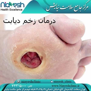 درمان زخم دیابت کلینیک نیایش