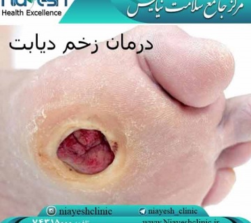 درمان زخم دیابت کلینیک نیایش
