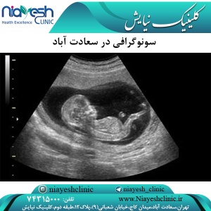 سونوگرافی در سعادت آباد