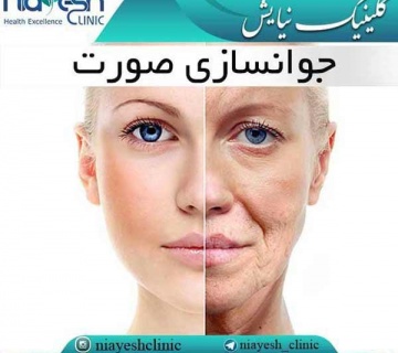 جوانسازی صورت کلینیک نیایش