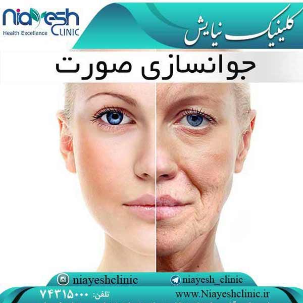 جوانسازی صورت کلینیک نیایش