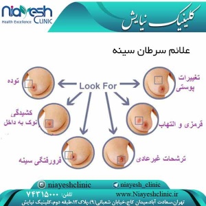 علائم سرطان سینه کلینیک نیایش