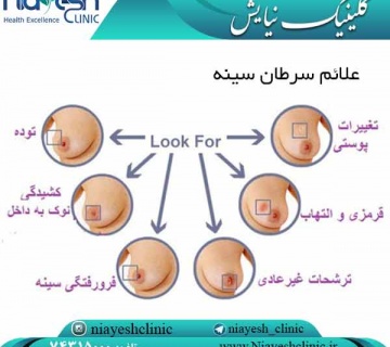 علائم سرطان سینه کلینیک نیایش
