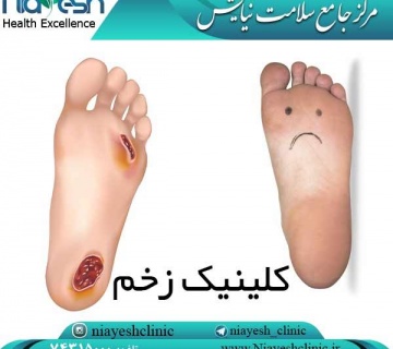 کلینیک زخم کلینیک نیایش