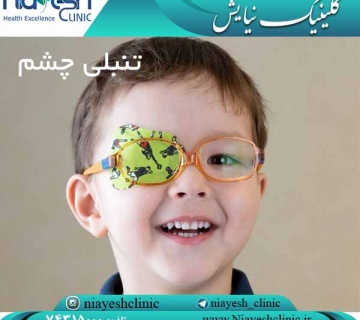 تنبلی چشم کلینیک نیایش