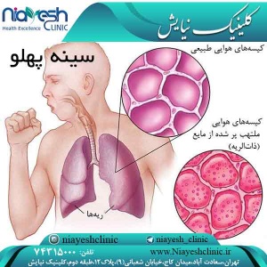 سینه پهلو کلینیک نیایش