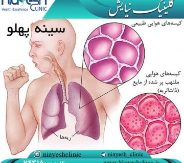 سینه پهلو کلینیک نیایش