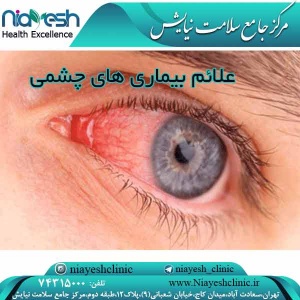 علائم بیماری های چشمی کلینیک نیایش
