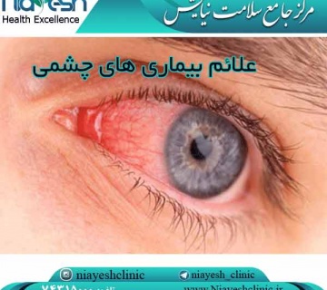 علائم بیماری های چشمی کلینیک نیایش