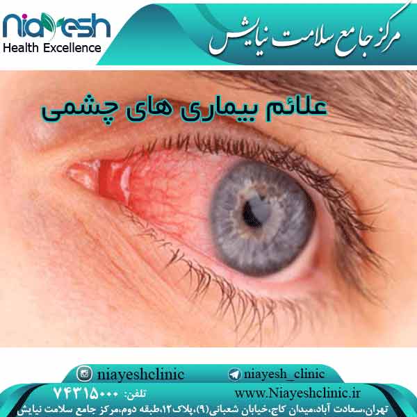 علائم بیماری های چشمی کلینیک نیایش