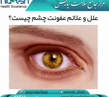 علل و علائم عفونت چشم چیست؟ کلینیک نیایش