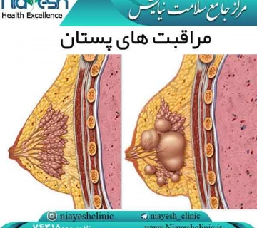 مراقبت های پستان کلینیک نیایش