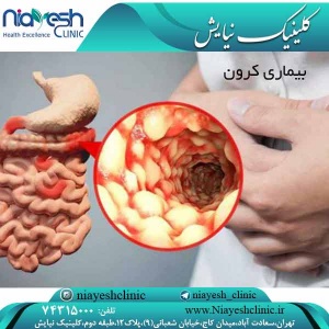 بیماری کرون کلینیک نیایش