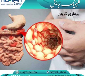 بیماری کرون کلینیک نیایش