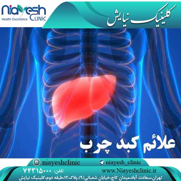 علائم کبد چرب کلینیک نیایش