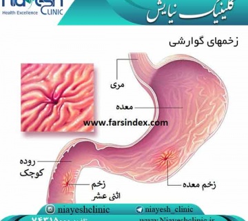 زخمهای گوارشی کلینیک نیایش