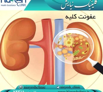 عفونت کلیه کلینیک نیایش