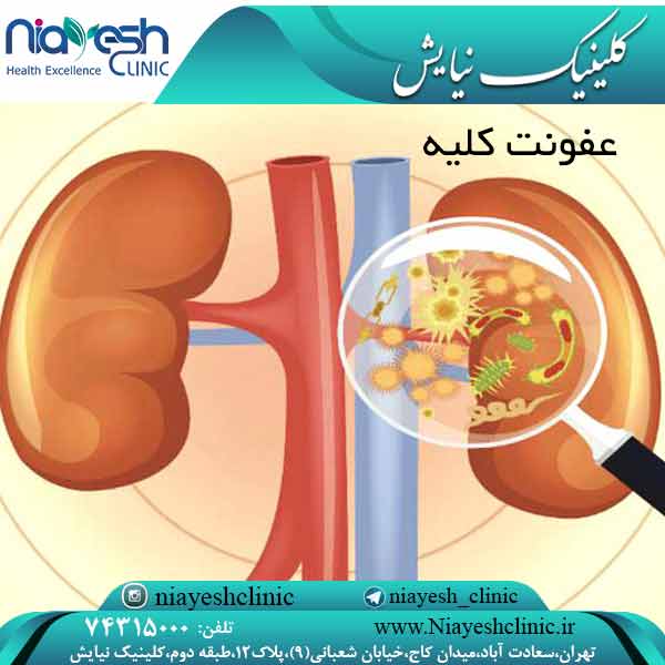 عفونت کلیه کلینیک نیایش