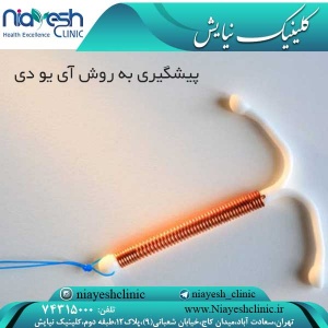 پیشگیری به روش آی یو دی کلینیک نیایش