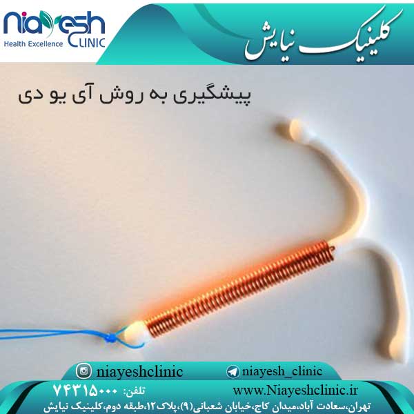 پیشگیری به روش آی یو دی کلینیک نیایش