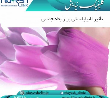 تأثیر لابیاپلاستی بر رابطه جنسی کلینیک نیایش