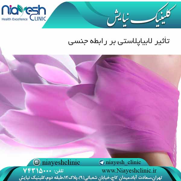 تأثیر لابیاپلاستی بر رابطه جنسی کلینیک نیایش