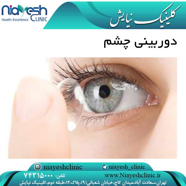 دوربینی چشم کلینیک نیایش