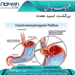 برگشت اسید معده کلینیک نیایش
