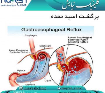 برگشت اسید معده کلینیک نیایش