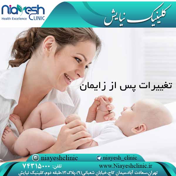 تغییرات پس از زایمان کلینیک نیایش