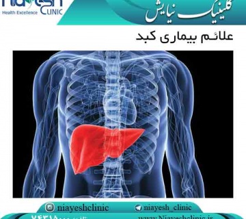 علائم بیماری کبد کلینیک نیایش