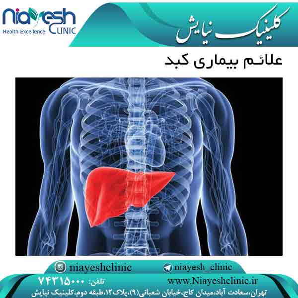 علائم بیماری کبد کلینیک نیایش