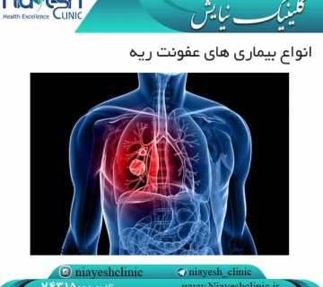 انواع بیماری های عفونت ریه کلینیک نیایش