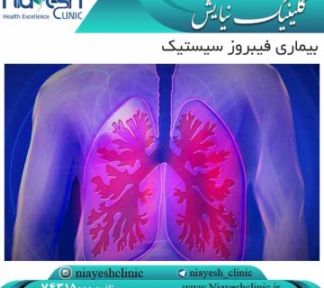 بیماری فیبروز سیستیک کلینیک نیایش