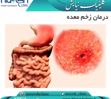 درمان زخم معده کلینیک نیایش