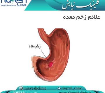 علائم زخم معده کلینیک نیایش