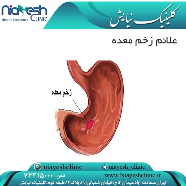 علائم زخم معده کلینیک نیایش