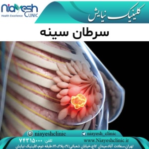 سرطان سینه