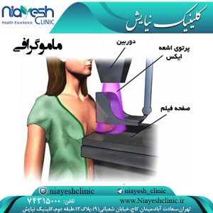 ماموگرافی