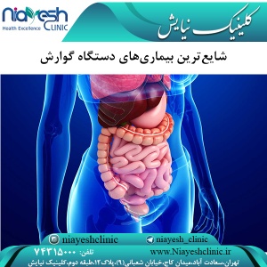 شایع‌ترین بیماری‌های دستگاه گوارش