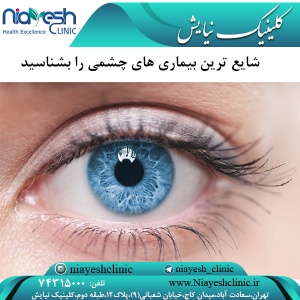 شایع ترین بیماری های چشمی را بشناسید