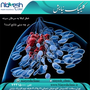 خطر ابتلا به سرطان سینه در چه سنی شایع است؟