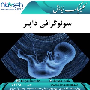 سونوگرافی داپلر