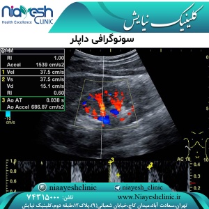 سونوگرافی داپلر