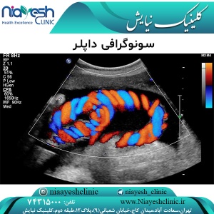 سونوگرافی داپلر