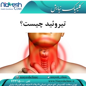 تیروئید چیست؟