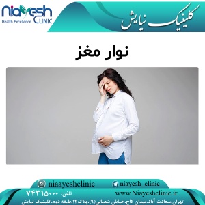 نوار مغز