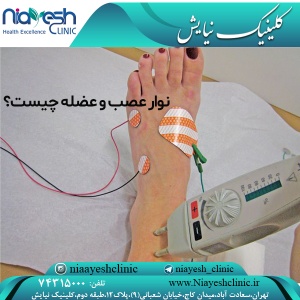 نوار عصب و عضله چیست؟