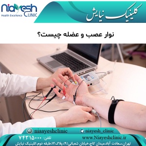 نوار عصب و عضله چیست؟