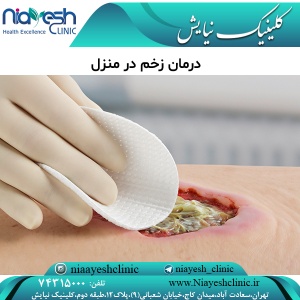 درمان زخم در منزل